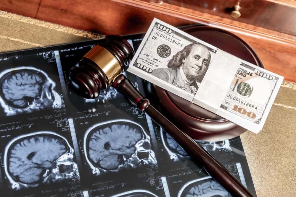 A collage combining brain MRI scans, a judge's gavel, and US currency, symbolizing medical-legal issues.